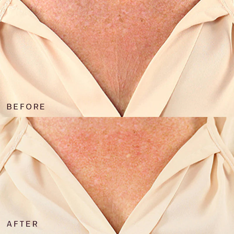 Wrinkle Smoothing Chest Patch