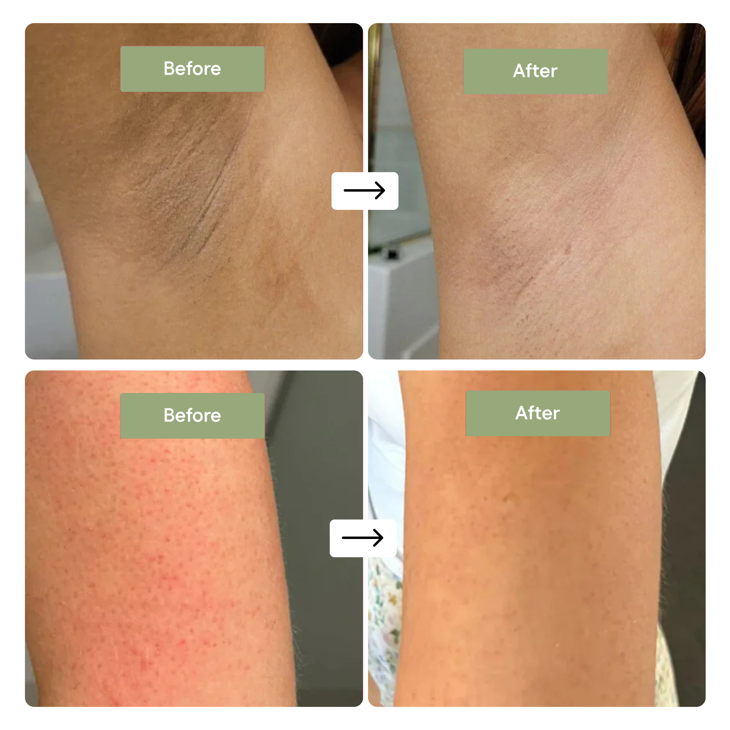 Peel Shot - Kojic + Turmeric Body Peel Spray