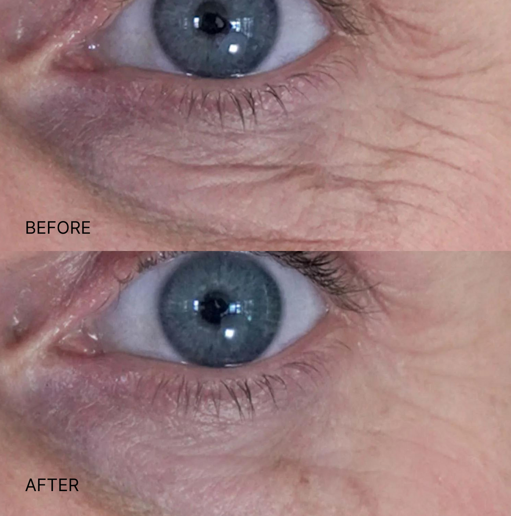 Wrinkle Smoothing Eyes & Smile Patches