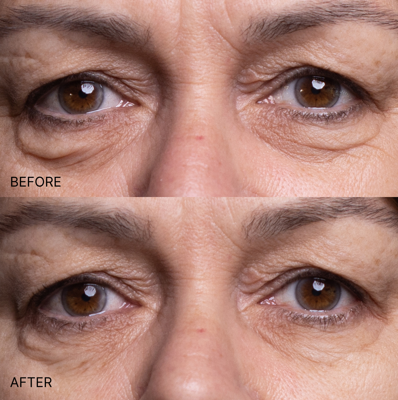 Wrinkle Smoothing Eyes & Smile Patches