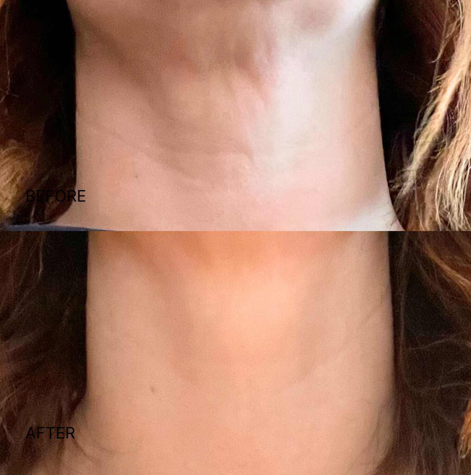 Wrinkle Smoothing Neck Patch